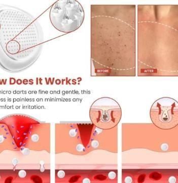 Skin Tag Remover Patch